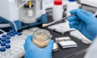 Is Urolithin A Legal in Your Market?